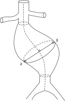 https://www.polradiol.com/f/fulltexts/114057/PJR-84-39426-g001_min.jpg