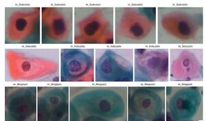 Figure from article: Attention-enhanced deep...