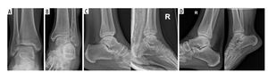 Figure from article: Assessment of X-ray ankle...