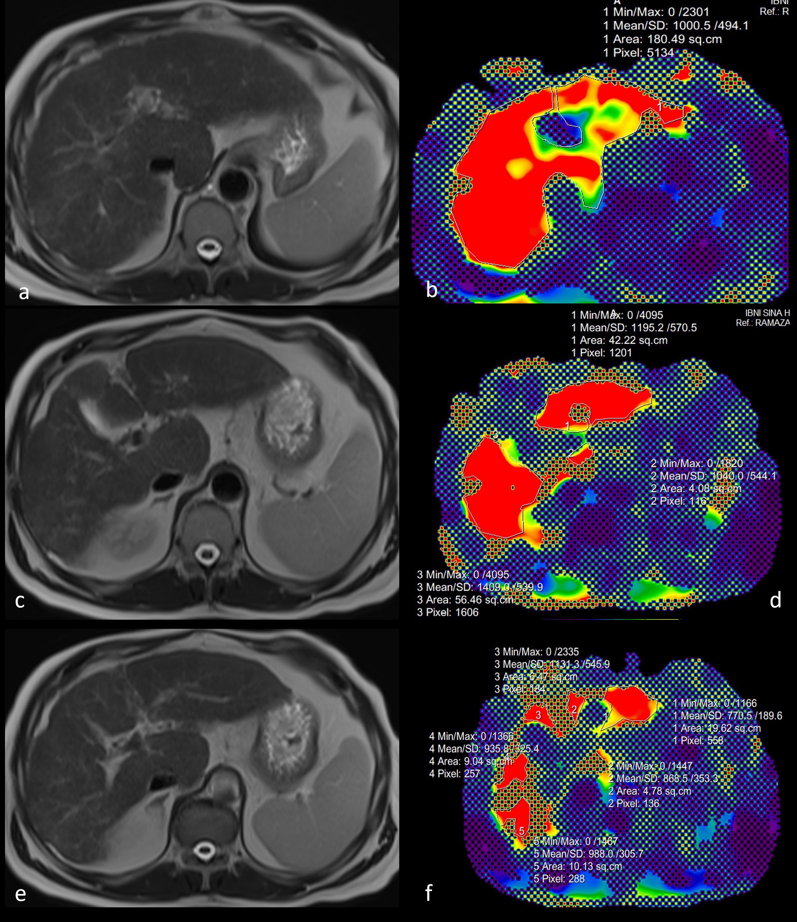 Figure from article: The efficacy of magnetic...