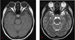 Figure from article: Magnetic resonance imaging...