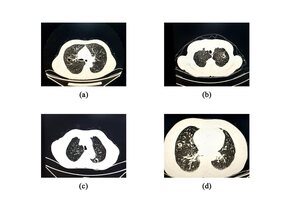 Figure from article: Analysis of risk factors...