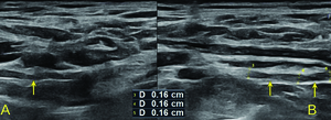 Figure from article: The role of ultrasonography...