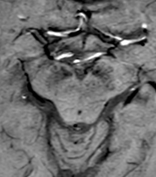 Figure from article: Magnetic Resonance Imaging...