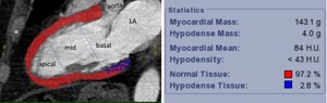 Figure from article: Quantitative myocardial...