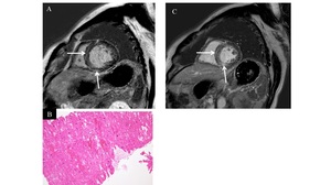 Figure from article: Interpretation of cardiac...