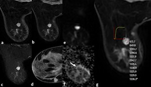 Figure from article: Factors associated with...