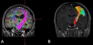 Figure from article: Deterministic or...