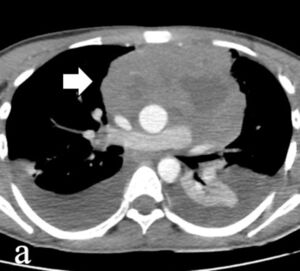Figure from article: Safety and diagnostic...