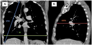 Figure from article: Body mass index and...