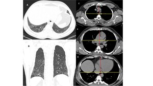 Figure from article: Quantitative assessment...