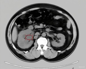 Figure from article: Secondary signs combined...