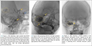 Figure from article: Coexistence of brain...