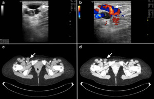 Figure from article: The “yin-yang” sign in...